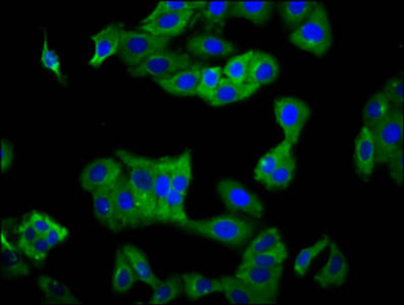 KIR2DS5 Antibody (PACO60020)
