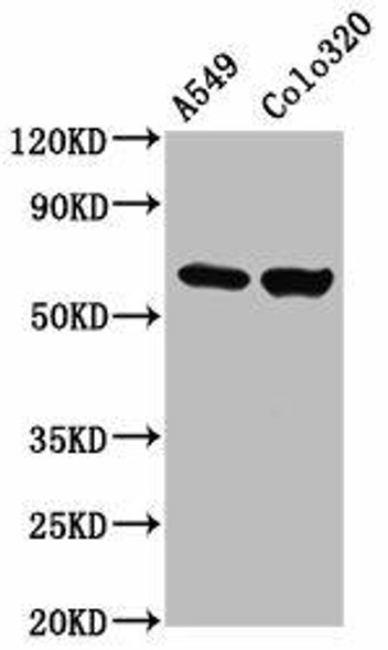 PDILT Antibody (PACO60220)