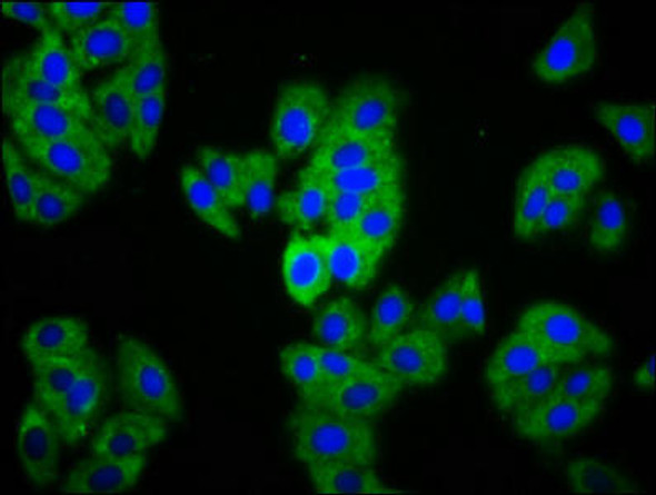 MAGI1 Antibody (PACO60316)