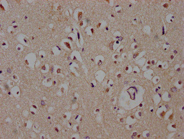 DACT1 Antibody (PACO60360)