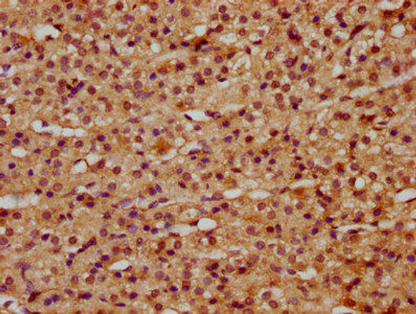 RILP Antibody (PACO61121)