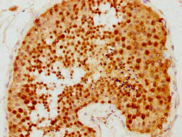 SMC6 Antibody (PACO61654)