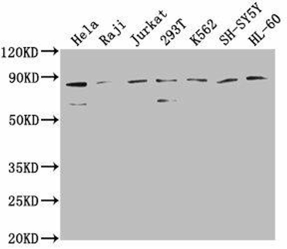 ZRANB1 Antibody (PACO62107)