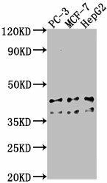 RHBDD3 Antibody (PACO63403)