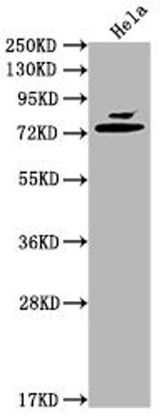 Mmp2 Antibody (PACO64303)