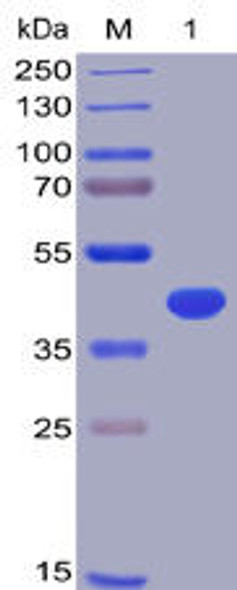 Human BCMA Recombinant Protein (hFc-His Tag) (HDPT0001)