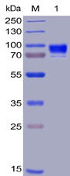 Human CD123 Recombinant Protein (hFc-His Tag) (HDPT0003)