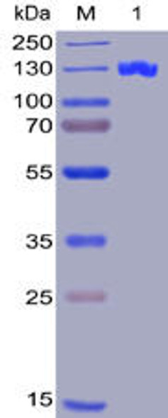 Human CD22 Recombinant Protein (hFc-His Tag) (HDPT0005)