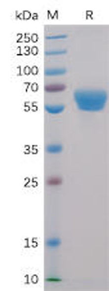 Human 4-1BB Recombinant Protein (mFc-His Tag) (HDPT0011)