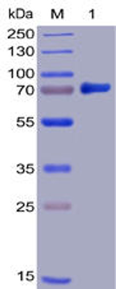 Human B7-H3 Recombinant Protein (mFc-His Tag) (HDPT0012)