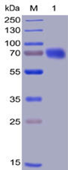 Human CD28 Recombinant Protein (mFc-His Tag) (HDPT0014)