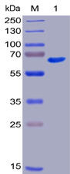 Human CD40 Recombinant Protein (mFc-His Tag) (HDPT0015)