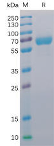 Human CD48 Recombinant Protein (mFc-His Tag) (HDPT0016)