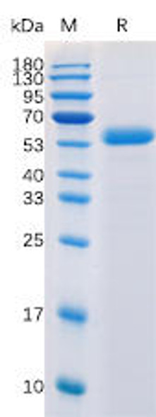 Human CTLA-4 Recombinant Protein (mFc-His Tag) (HDPT0017)