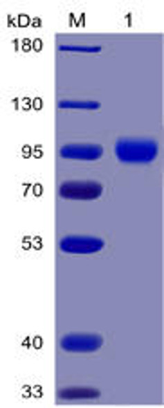 Human CD155 Recombinant Protein (mFc-His Tag) (HDPT0027)