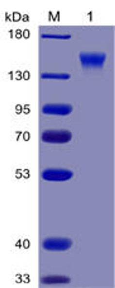 Human CD96 Recombinant Protein (mFc-His Tag) (HDPT0028)