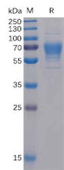 Human CD30 Ligand Recombinant Protein (mFc-His Tag) (HDPT0038)