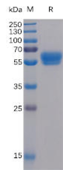 Human 4-1BB Ligand Recombinant Protein (mFc-His Tag) (HDPT0045)