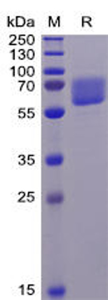 Human AXL Recombinant Protein (His Tag) (HDPT0055)