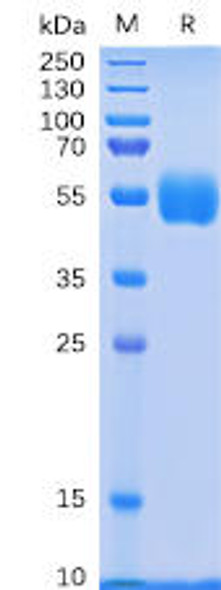 Human NKp30 Recombinant Protein (hFc Tag) (HDPT0062)
