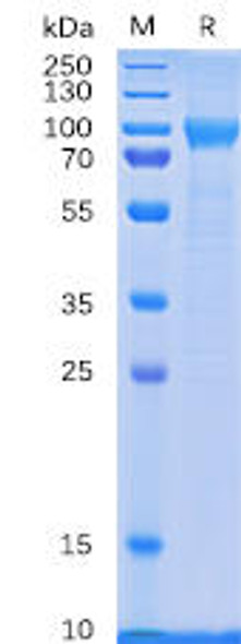 Human CD114 Recombinant Protein (His Tag) (HDPT0063)