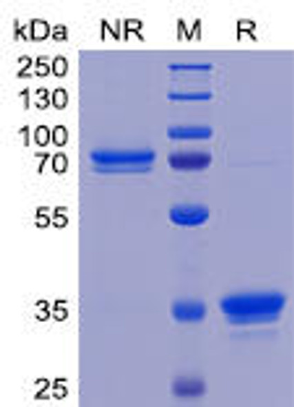 Human TweakR Recombinant Protein (mFc Tag) (HDPT0077)