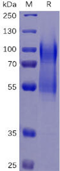 Human CD34 Recombinant Protein (His Tag) (HDPT0082)