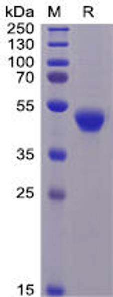 Human CD5 Recombinant Protein (His Tag) (HDPT0083)