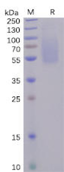 SARS-CoV-2 (2019-nCoV) S1 protein NTD, His Tag) (HDPT0098)