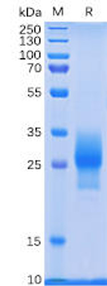 Human 4-1BB Recombinant Protein (His Tag) (HDPT0106)
