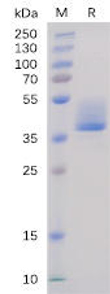 Human BAFF-R Recombinant Protein (hFc Tag) (HDPT0107)