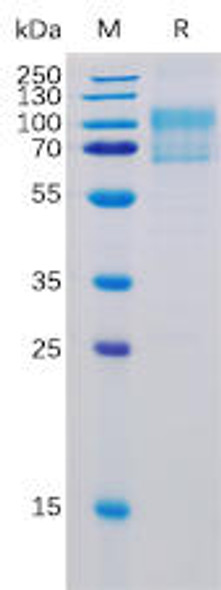 Human B7-1 Recombinant Protein (mFc-His Tag) (HDPT0122)