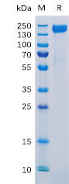 Human CD171 Recombinant Protein (His Tag) (HDPT0128)