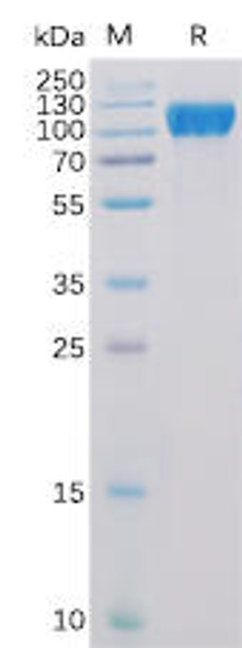 Human ACE2 Recombinant Protein (His Tag) (HDPT0130)