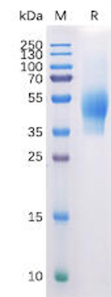Human CD44 Recombinant Protein (His Tag) (HDPT0133)