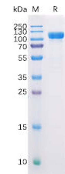 Human CD10 Recombinant Protein (hFc Tag) (HDPT0136)