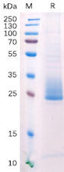 Human ANGPTL3 Recombinant Protein (His Tag) (HDPT0157)