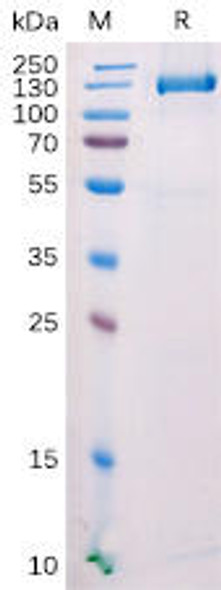 Mouse FAP Recombinant Protein (C-mFc Tag) (HDPT0159)