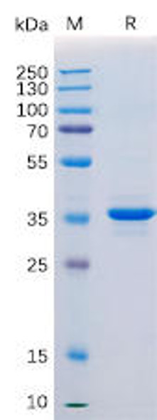 Human CD20 Recombinant Protein (hFc Tag) (HDPT0160)