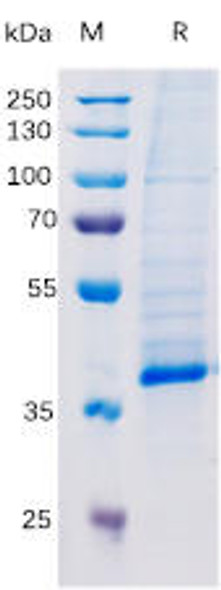 Human TGFB1 Recombinant Protein (hFc Tag) (HDPT0164)
