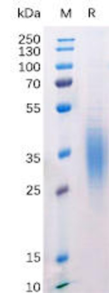 Mouse BTLA Recombinant Protein (His Tag) (HDPT0176)