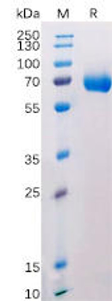 Human CD38 Recombinant Protein (hFc Tag) (HDPT0177)