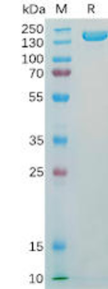 Human CD56 Recombinant Protein (hFc Tag) (HDPT0187)