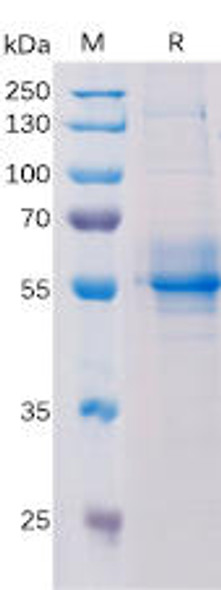 Human TMEM173 Recombinant Protein (hFc Tag) (HDPT0189)