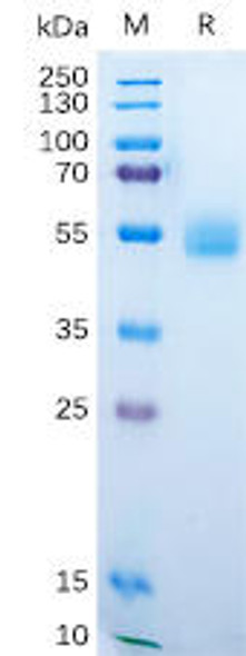 Human AMHR2 Recombinant Protein (hFc Tag) (HDPT0196)
