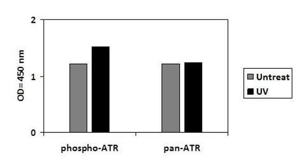 Human Phospho-ATR (T1989) and Total ATR PharmaGenie ELISA Kit (SBRS1756)