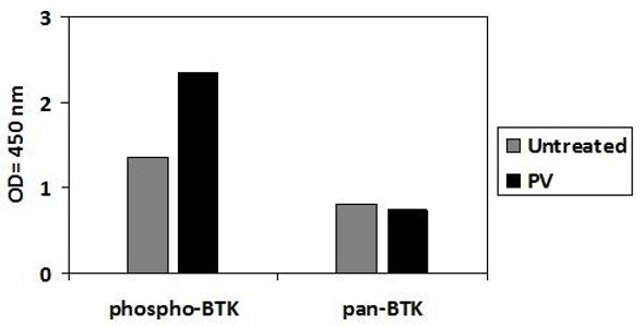 Human Phospho-BTK (Y551) and Total BTK PharmaGenie ELISA Kit (SBRS1767)