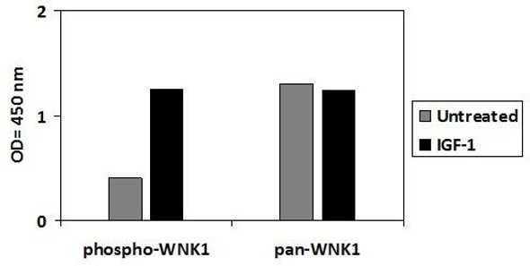 Human Phospho-WNK1 (T60) & Total WNK1 PharmaGenie ELISA Kit (SBRS2018)