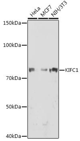 Anti-KIFC1 Antibody (CAB0077)