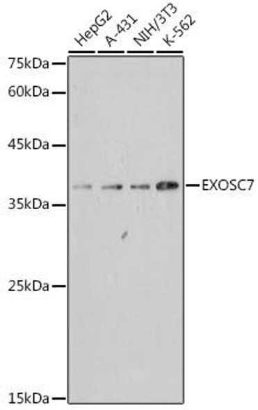 Anti-EXOSC7 Antibody (CAB0501)